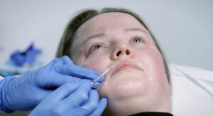 Anti-Wrinkle Injections - What to expect during your treatment