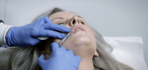 Lip Filler: Everything You Need To Know