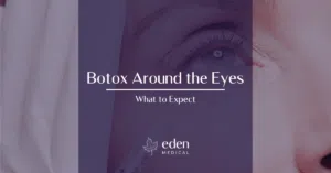 Botox Around the Eyes