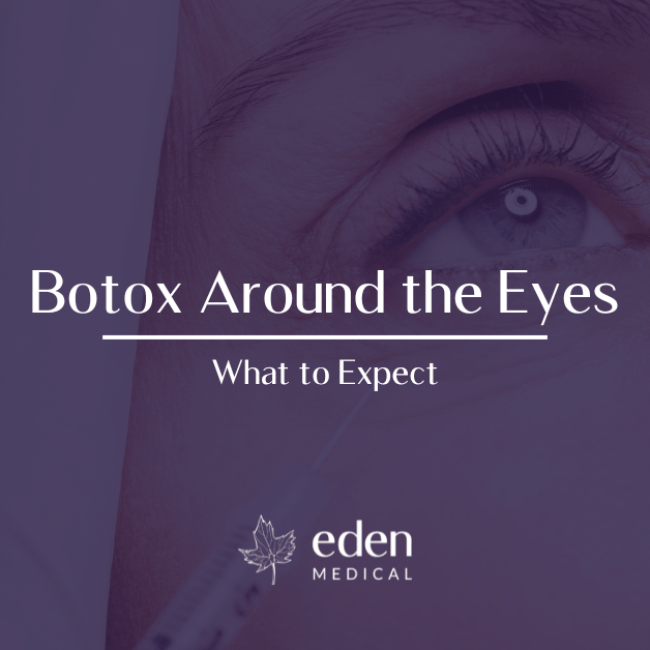 Botox Around the Eyes