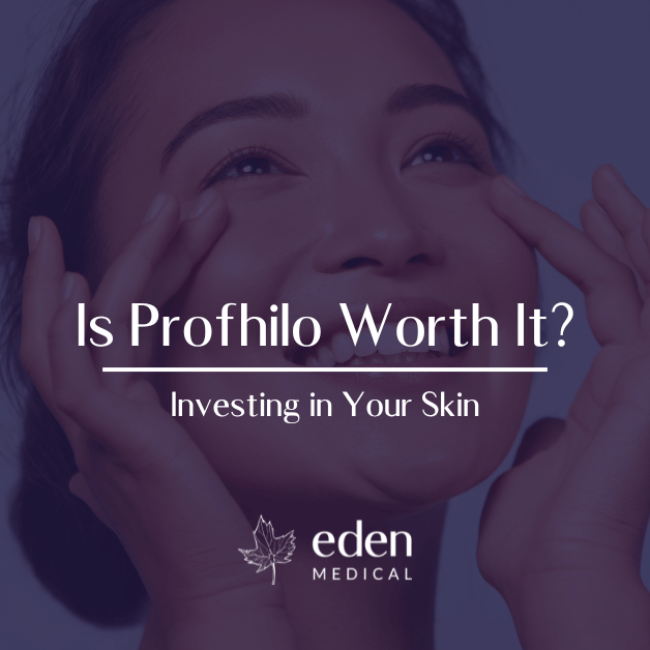 Is Profhilo Worth It?